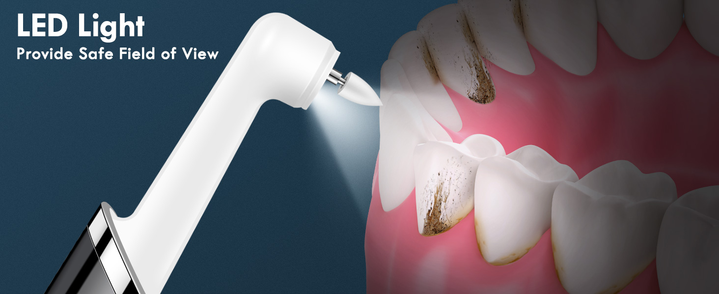 plaque remover