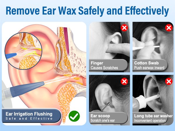 Ear Wax Removal Tool, Ear Irrigation Flushing System for Adults &amp; Kids, Perfect Ear Cleaning Kit