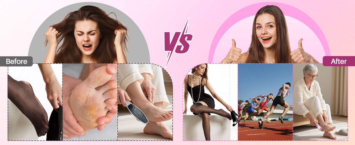 Adjustable Speed Foot File for Cracked Heels