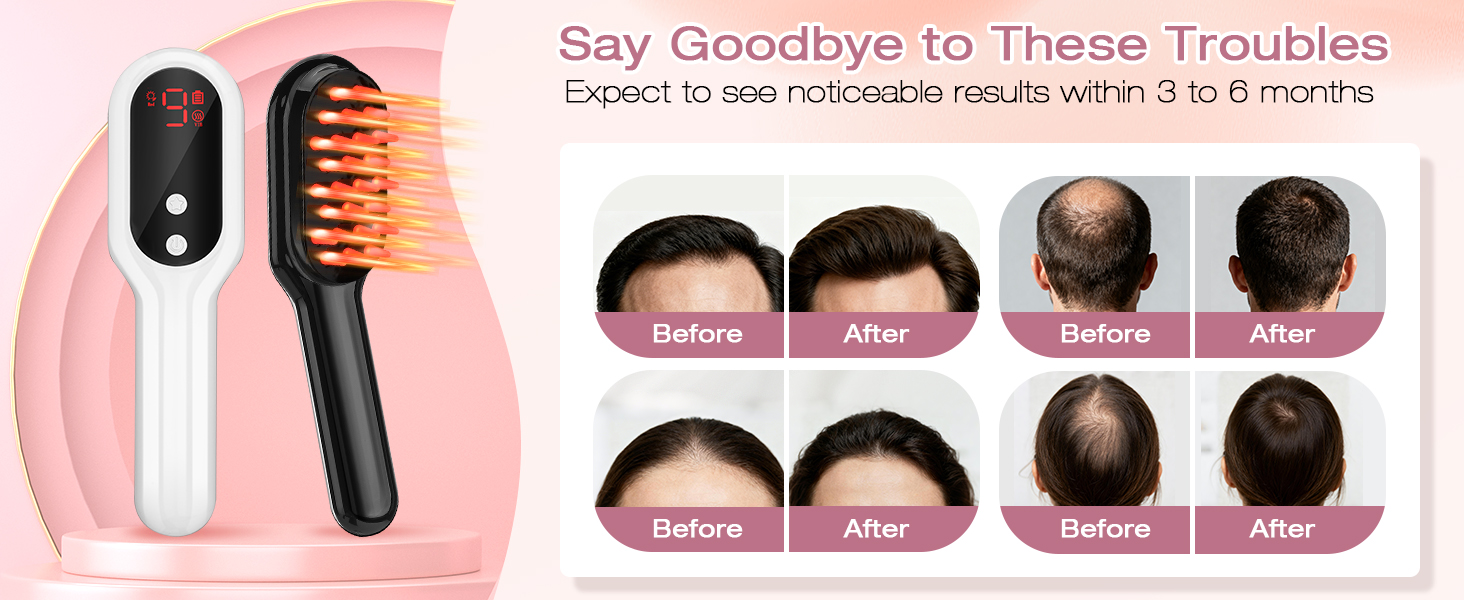 sniden hair growth spray