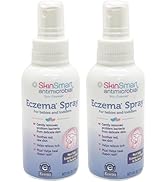 SkinSmart Eczema Spray for Babies and Toddlers, Removes Bacteria so Skin Can Heal, 4 Ounce Spray ...