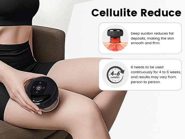 cupping kit for massage therapy