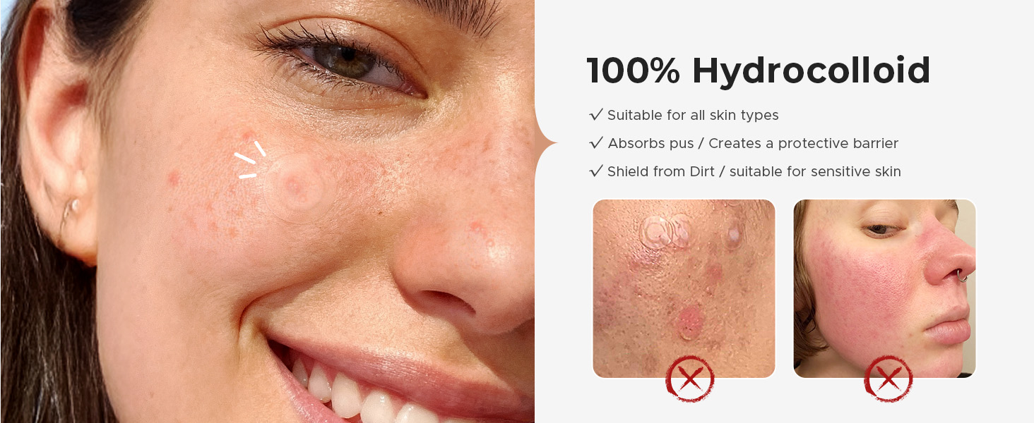 Pimple Patches