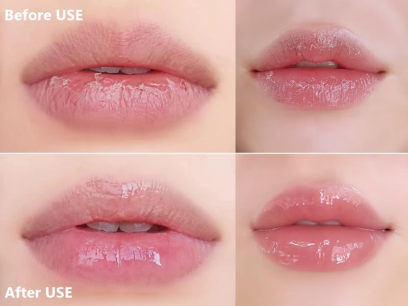 lip repair