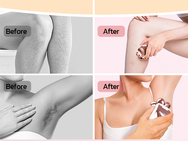 Electric Razors for Women Legs