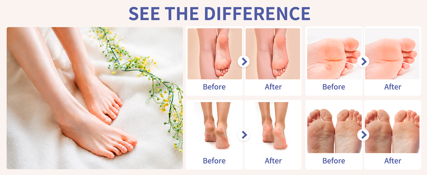 foot mask for dry cracked feet