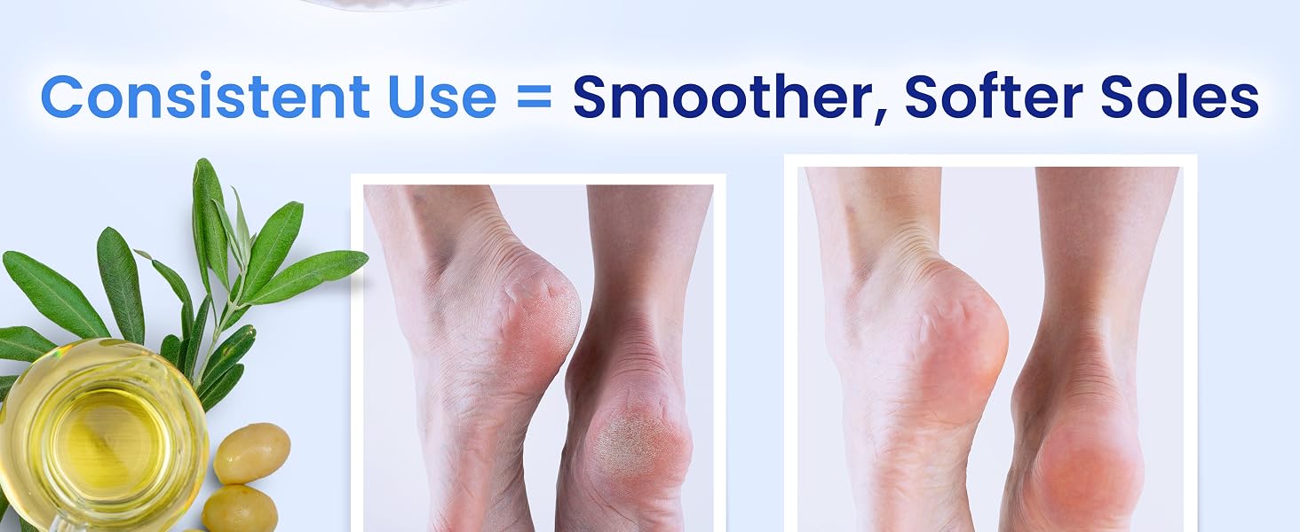 foot mask foot peel mask foot mask for dry cracked feet feet mask seoulskin foot mask foot peel mask