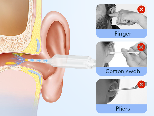 Ear Wax Vacuum