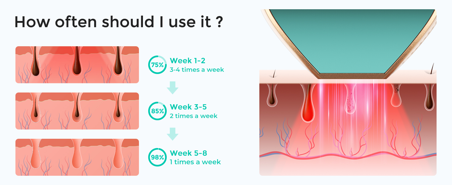 lubex ipl laser hair removal