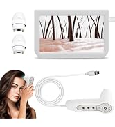 10.2 Inch Skin Diagnosis Hair Analyzer, LCD Screen Digital Skin Detector,Scalp Analysis Machine, ...