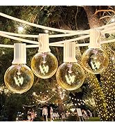 25Ft Dimmable Outdoor String Light, G40 Globe Patio Light with 26 2200K Edison Glass Bulbs(1 Extr...