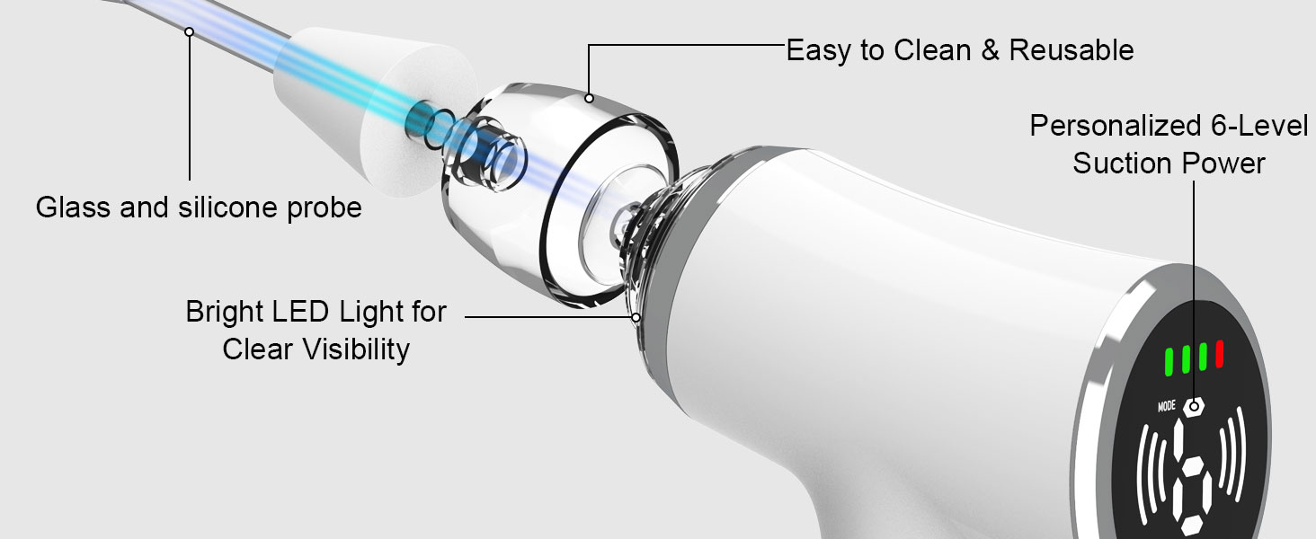 tonsil stone vacuum tonsil stone remover tonsil stone removal tonsil removal kit