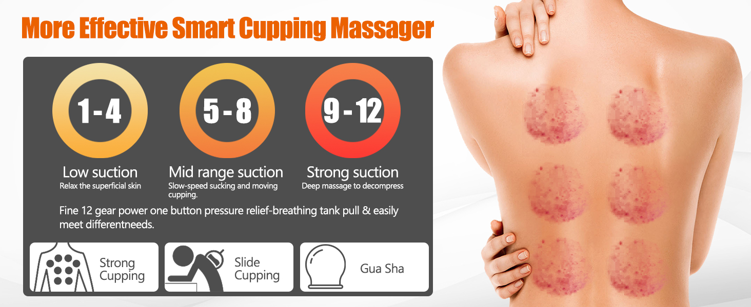 cupping set