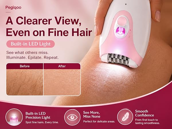 epilator