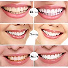  Whiten your Teeth, Shining your Smile