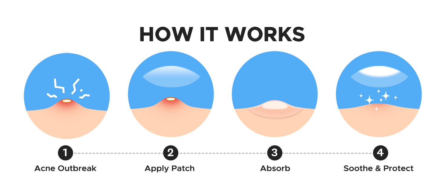 hydrocolloid acne patches