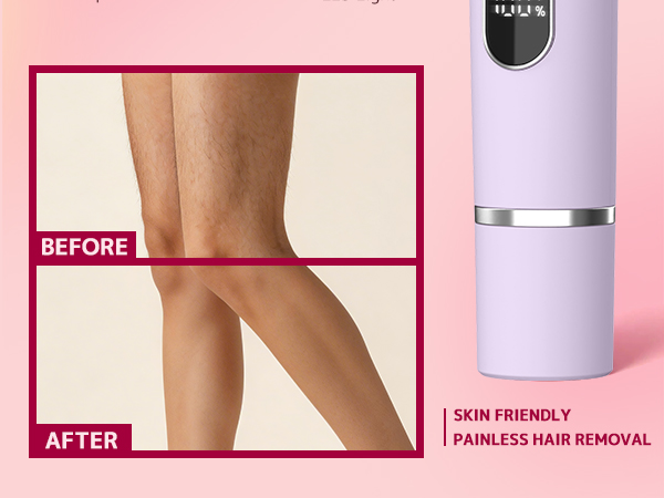 bikini trimmer