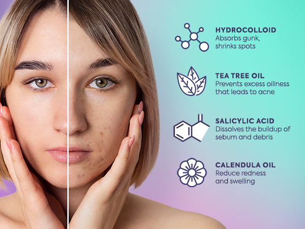 330 CT Circle Pimple Patches w/ Ingredients