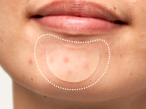Apply to skin and press lightly 5 seconds to make sure the acne patch is sticking securely.