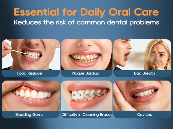 oral irrigator water flosser