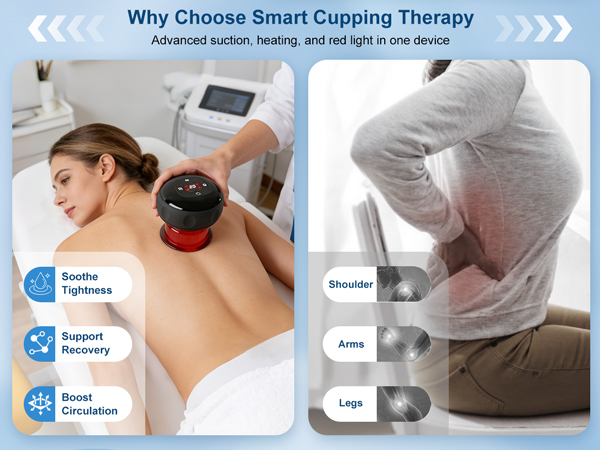 cupping therapy set
