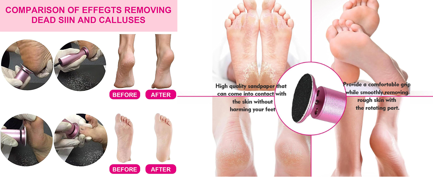 foot scrubber dead skin remover