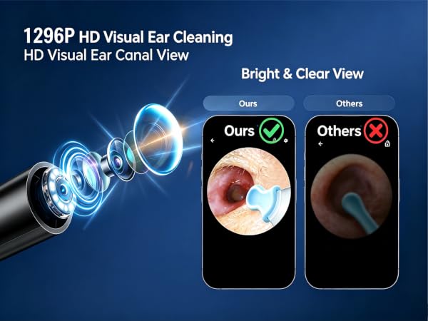 Bright clear P