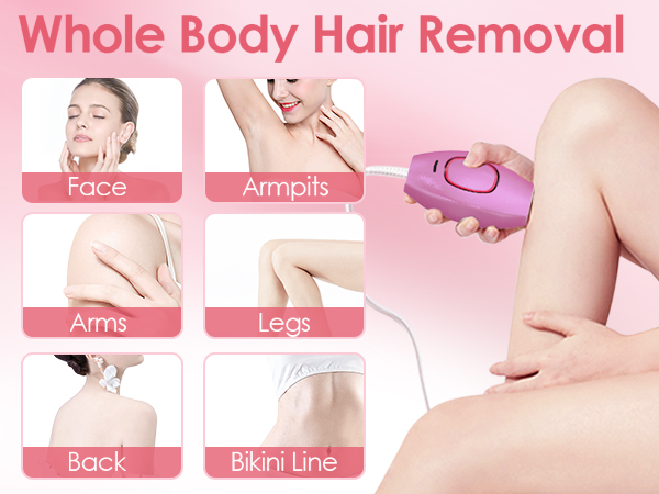 home laser hair removal