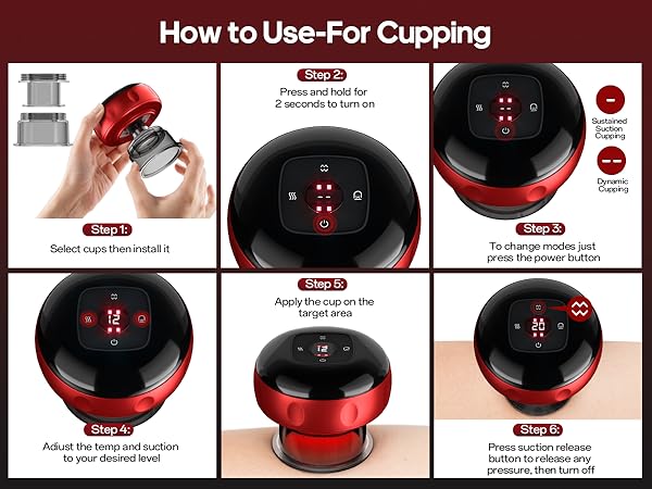cupping