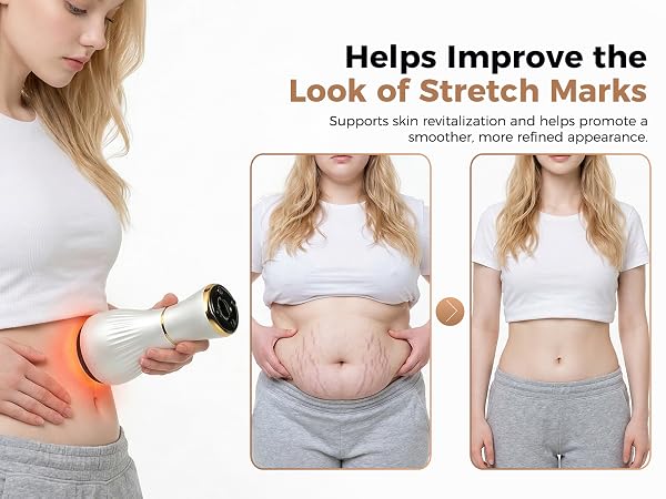 lymphatic drainage