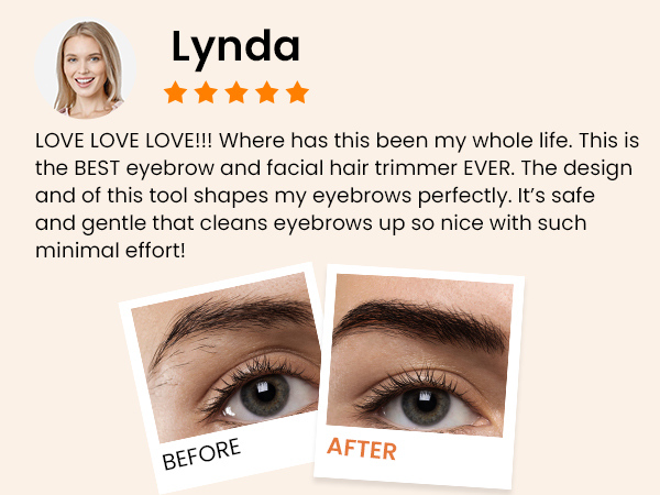 A10 REVIEW1-facial hair remover for women face