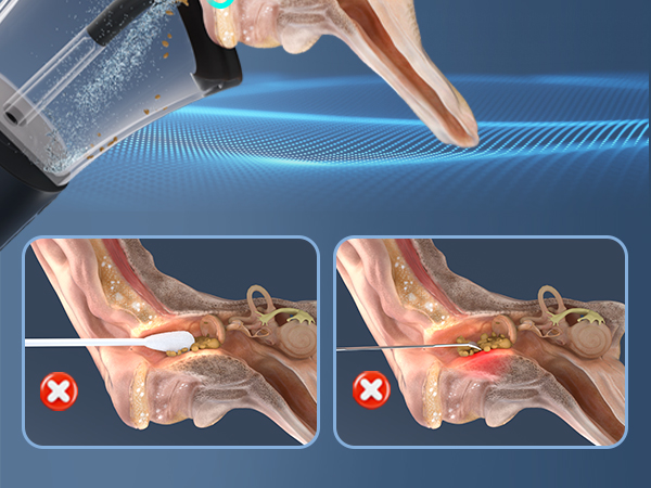 Medical device spraying mist into nose. Two diagrams show nasal passages, one with white substance and one with red highlighting, both marked with X symbols.