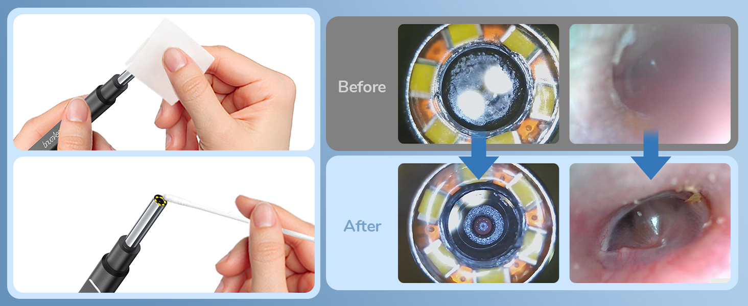 Cleaning for Otoscope Camera
