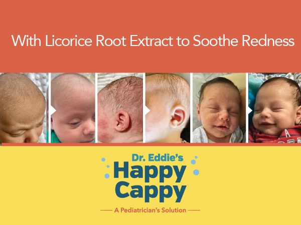 with licorice root extract to soothe redness