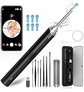 Ear Wax Removal, Ear Cleaning kit with 1296P Camera, Ear Camera with 6 LED Lights, Earwax Remover...
