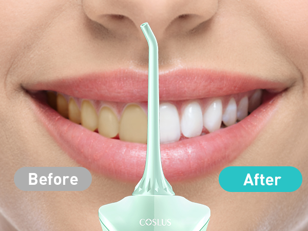 water dental flosser pick teeth cordlss portable Hilo dental con agua, recoge los dientes