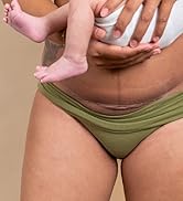 Lansinoh C Section Recovery Must Haves Pads, Postpartum Essentials for Scar Care, 4 Sterilized Pa...