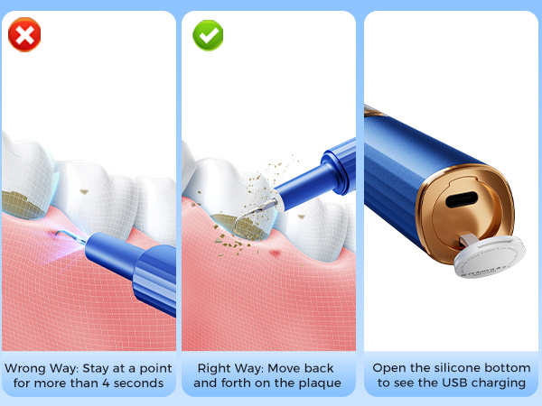 teeth cleaning tools