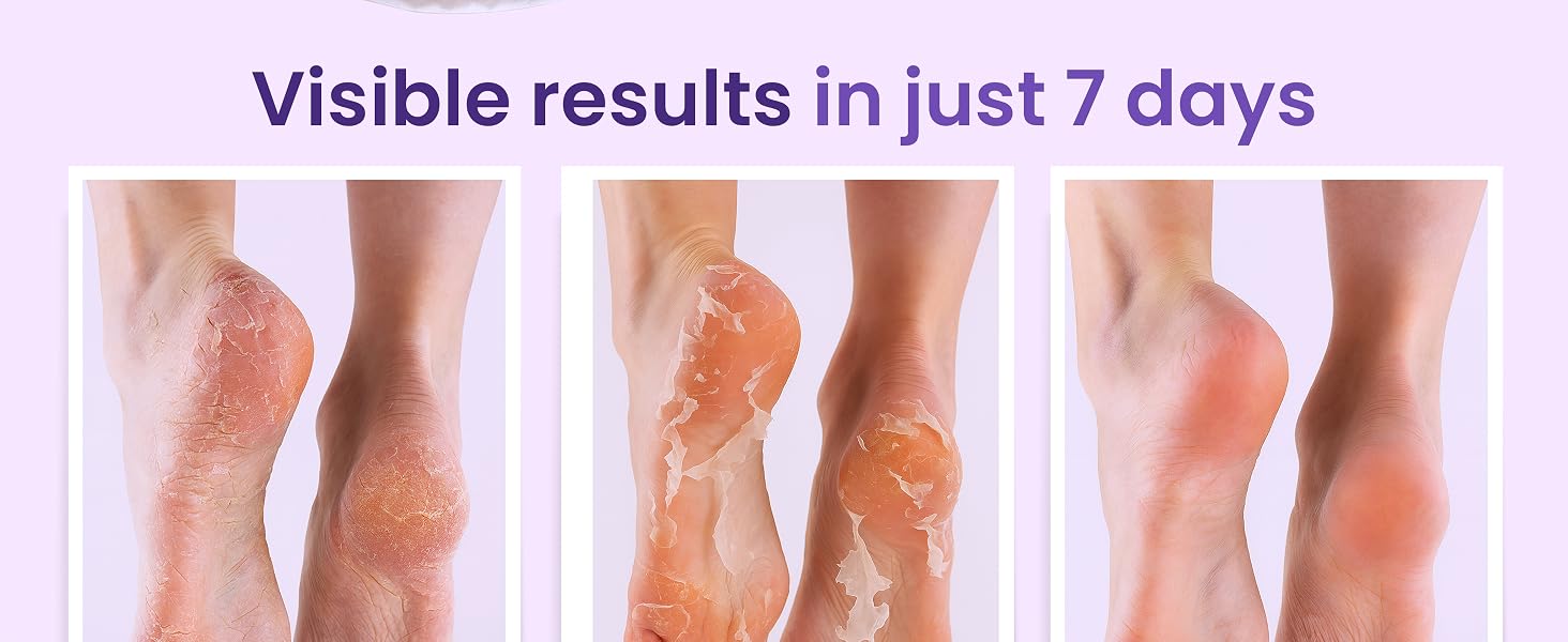 Text reads "Visible results in just 7 days". Four before-and-after comparison images of feet showing progressive skin improvement on pink background.