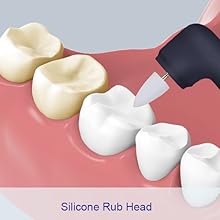Tooth Polisher
