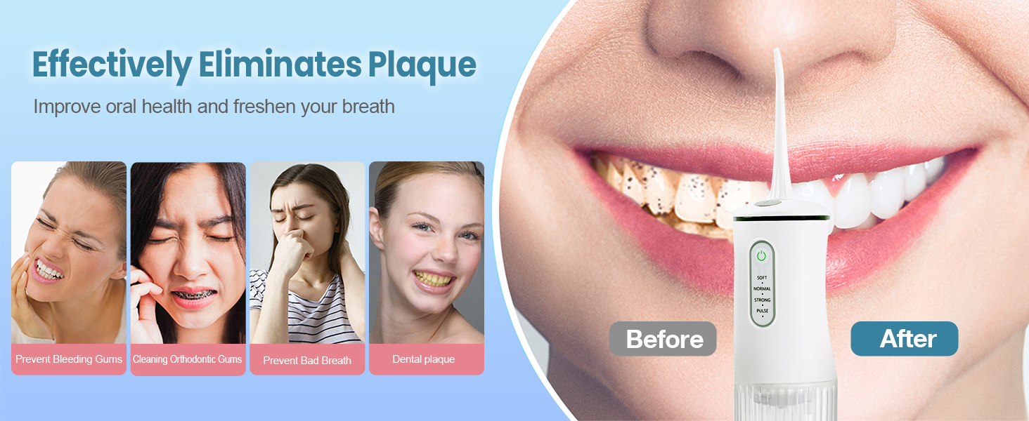 Water Flosser for Teeth