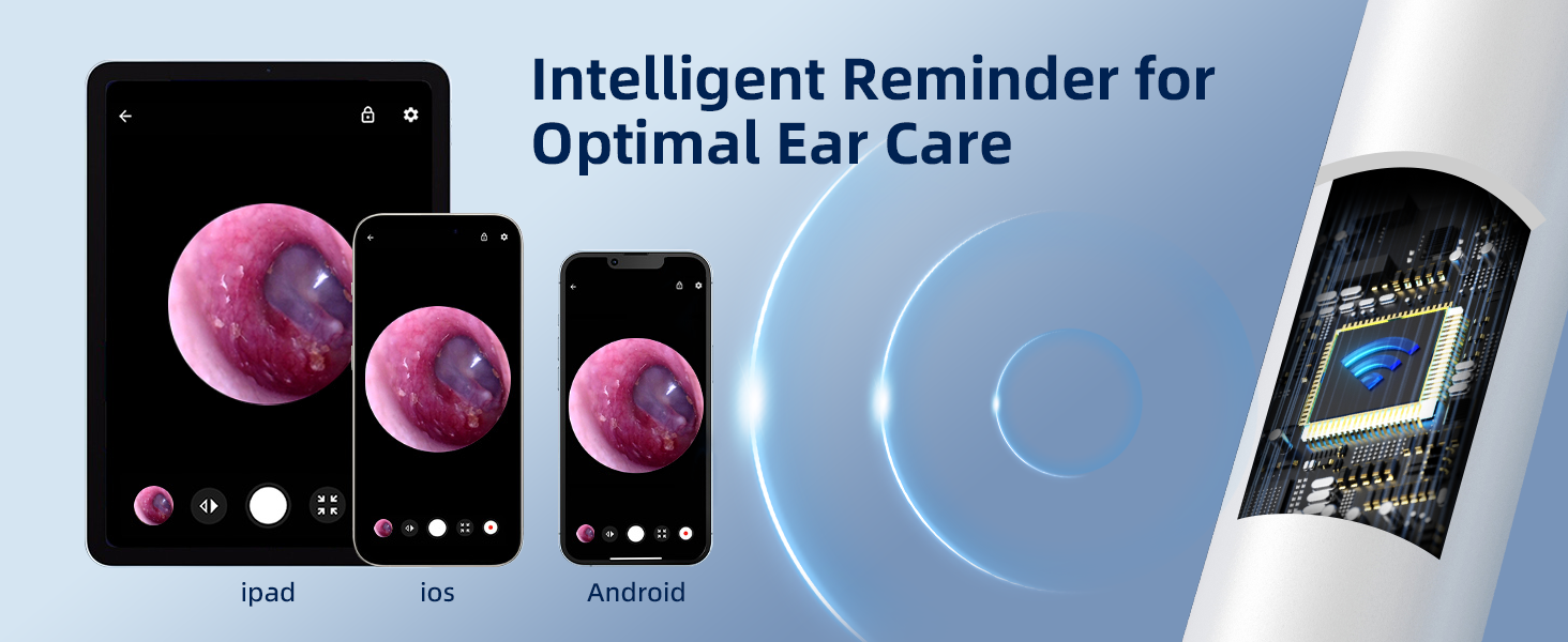 otoscope ear camera