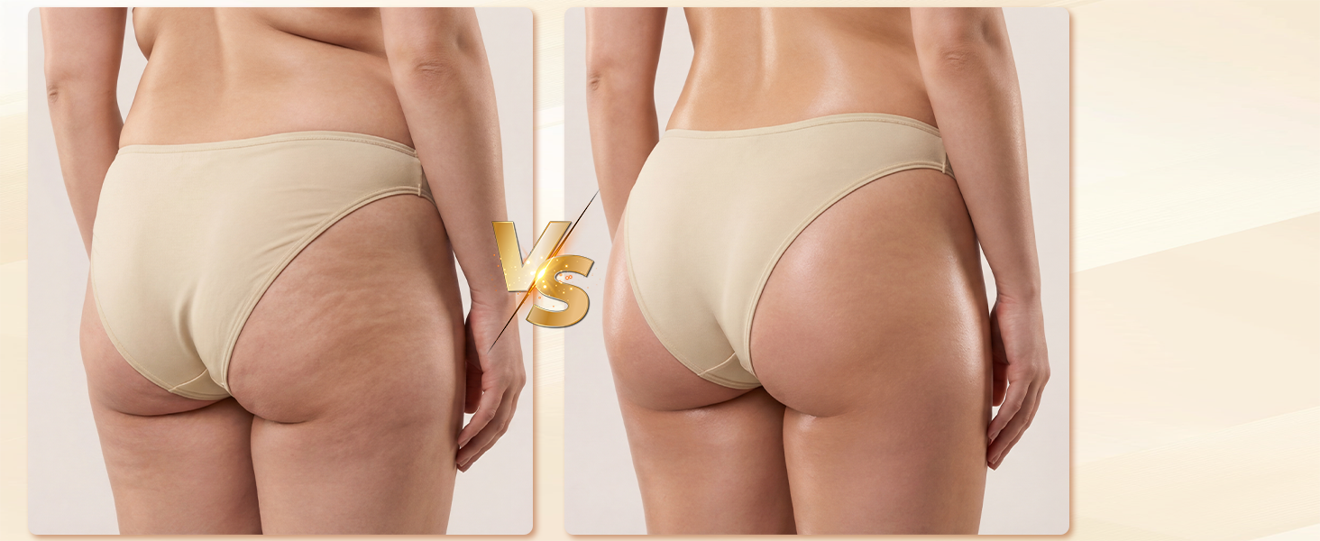 Body Sculpting Machine