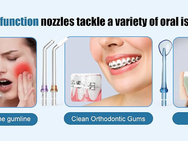 The h2ofloss water flosser comes with 13 tips for a variety of dental needs