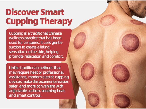 cupping set cupping therapy set cupping kit for massage therapy
