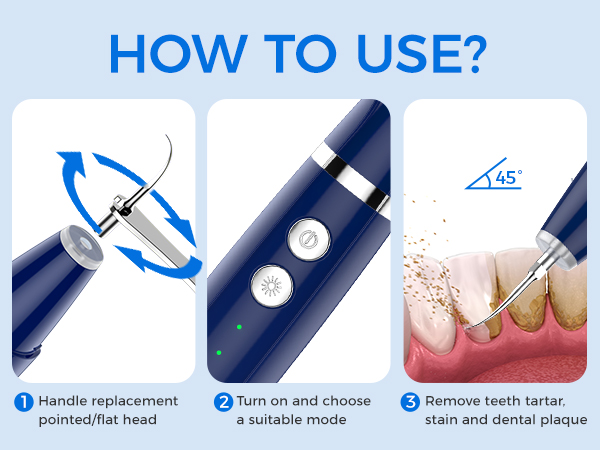 tartar remover