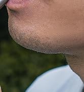 whistle