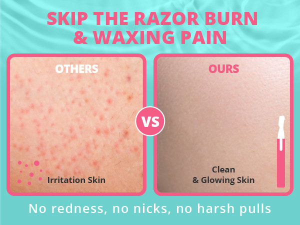 skip the razor burn