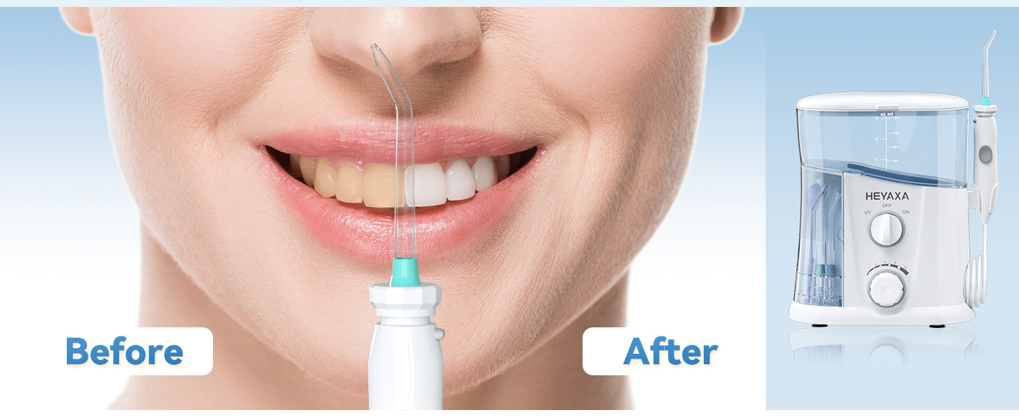 BEFORE-AFTER