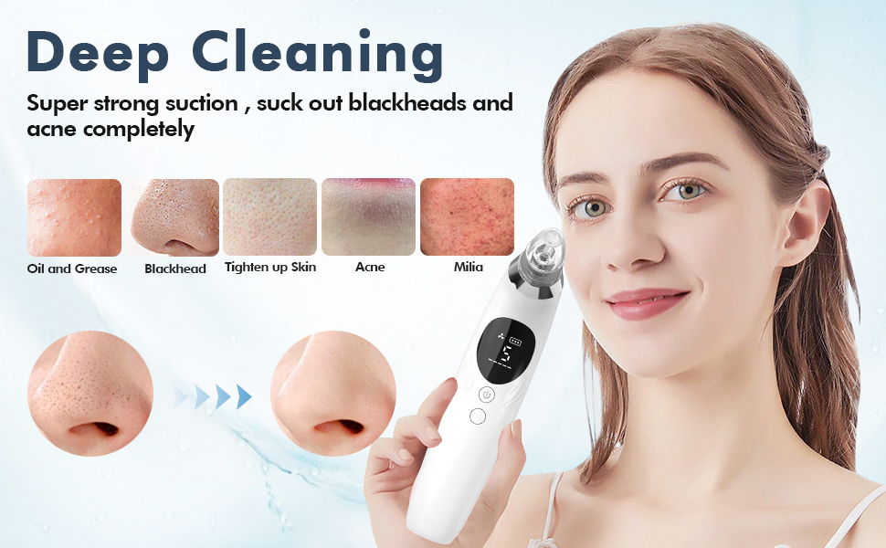 Blackhead Remover